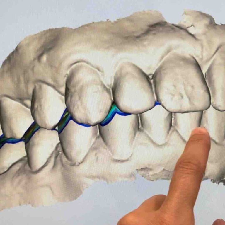Skanowanie zębów- na czym polega i do czego służy?