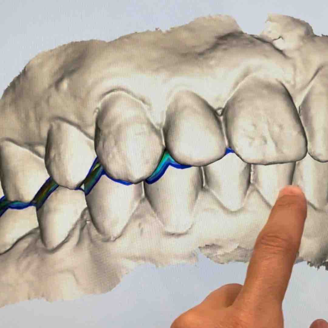 Model cyfrowy zębów